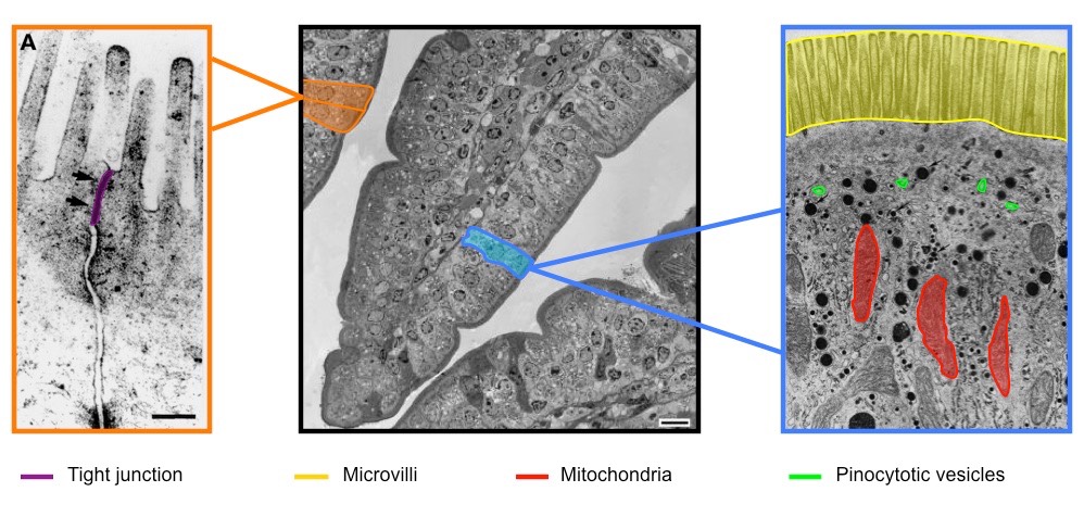 epithelial villus