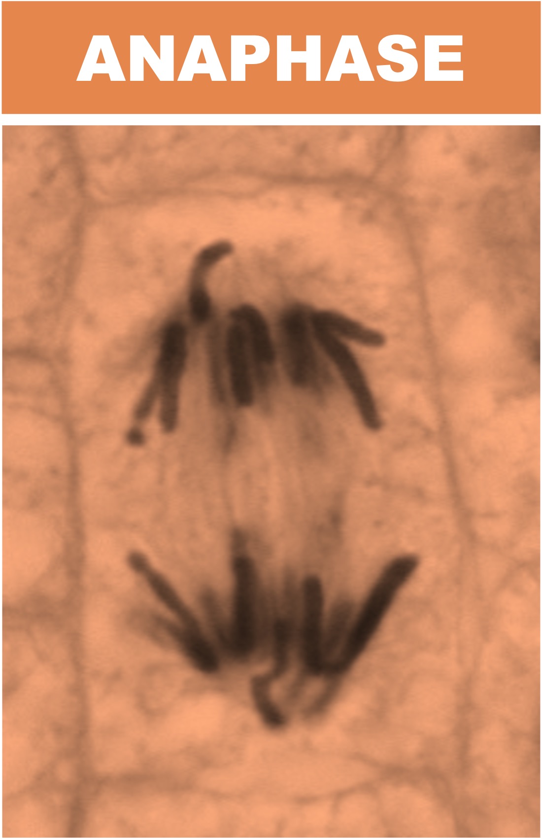anaphase%20micrograph