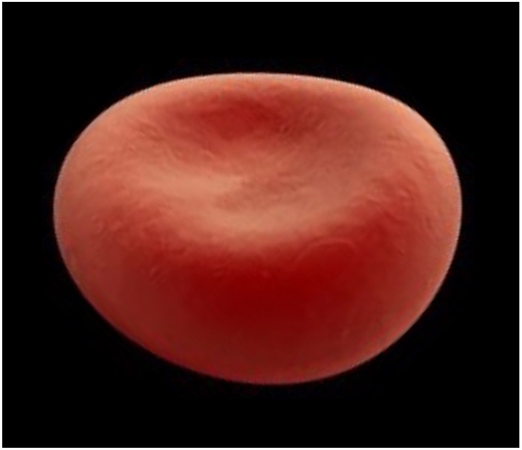 anemia1