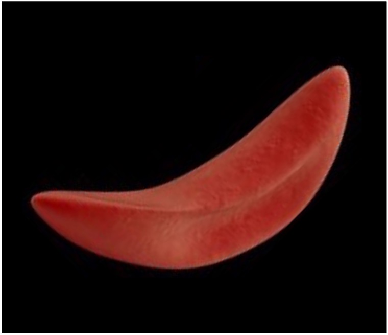 anemia2