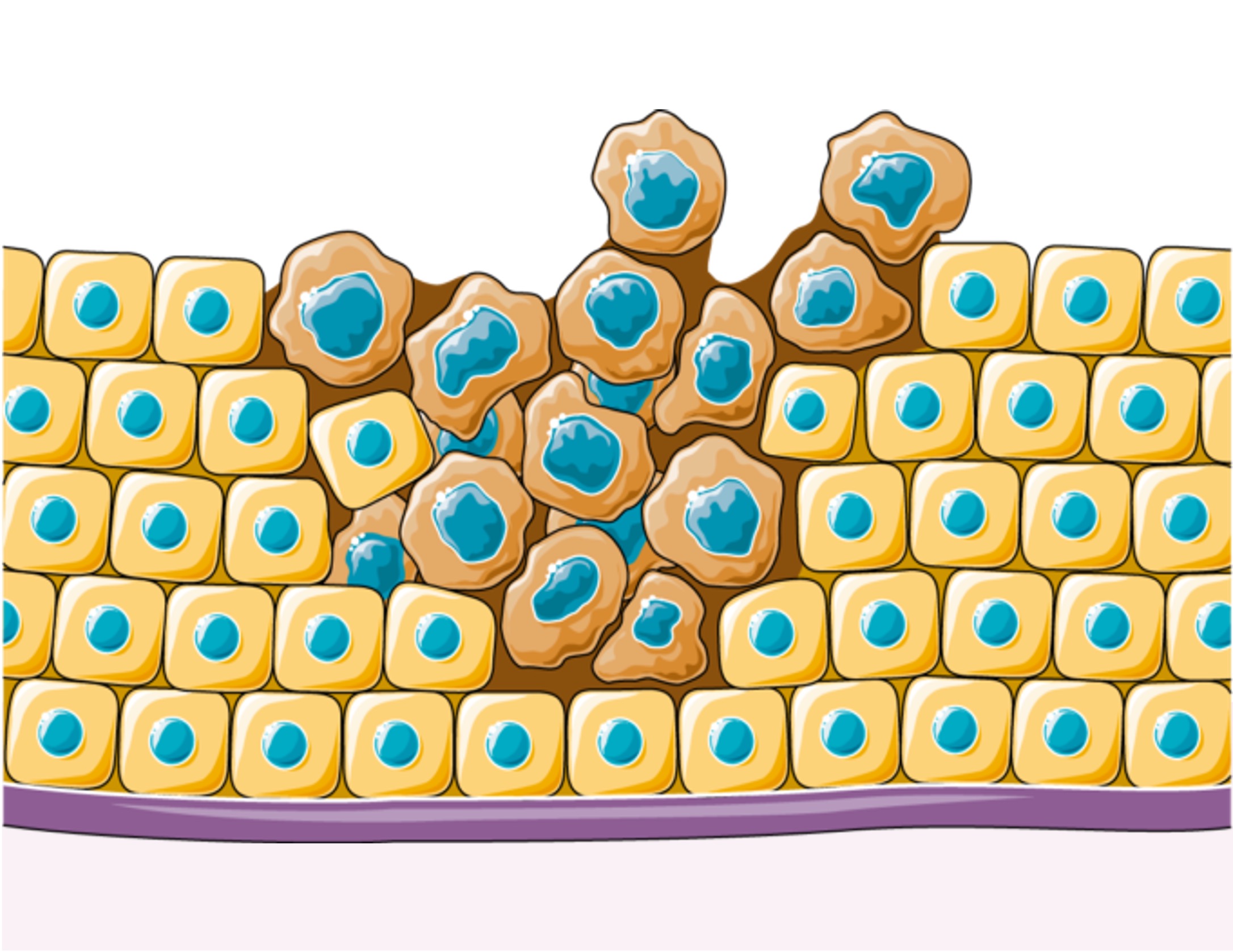 benign%20tumour%20ipad