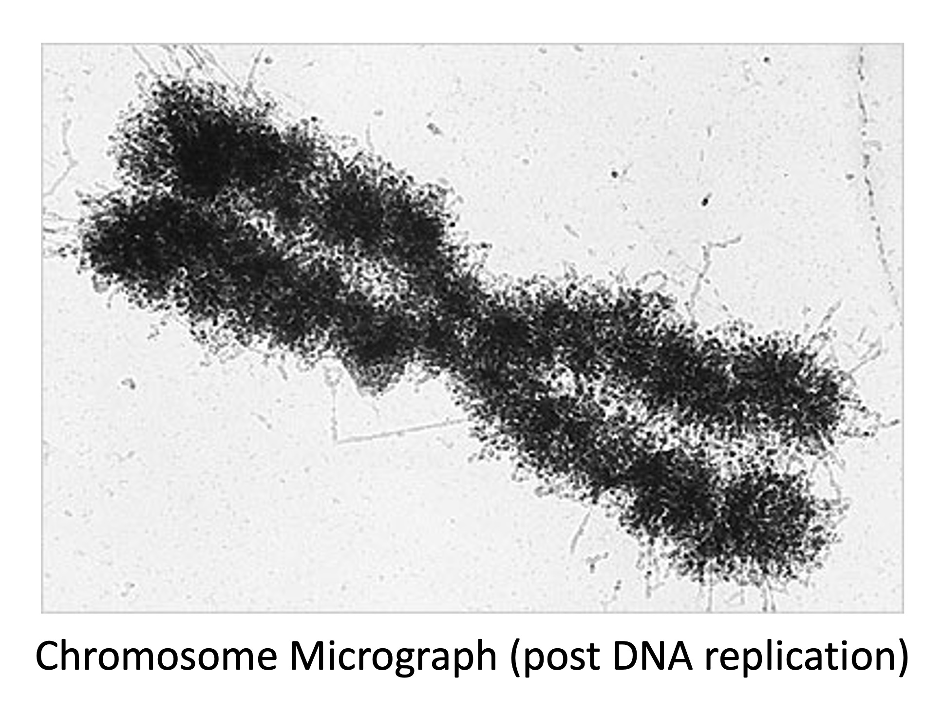 chromosome%20micrograph