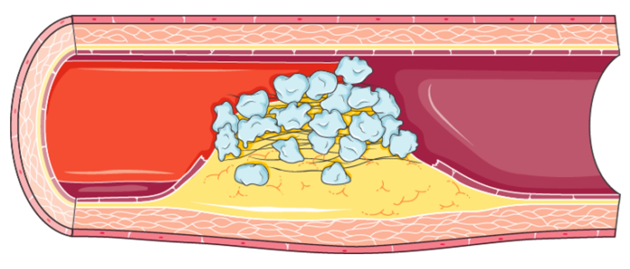 venous%20flow%20mobile