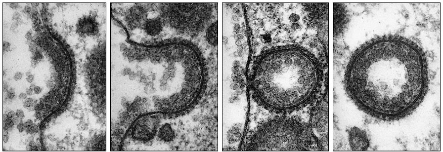 endocytosis1