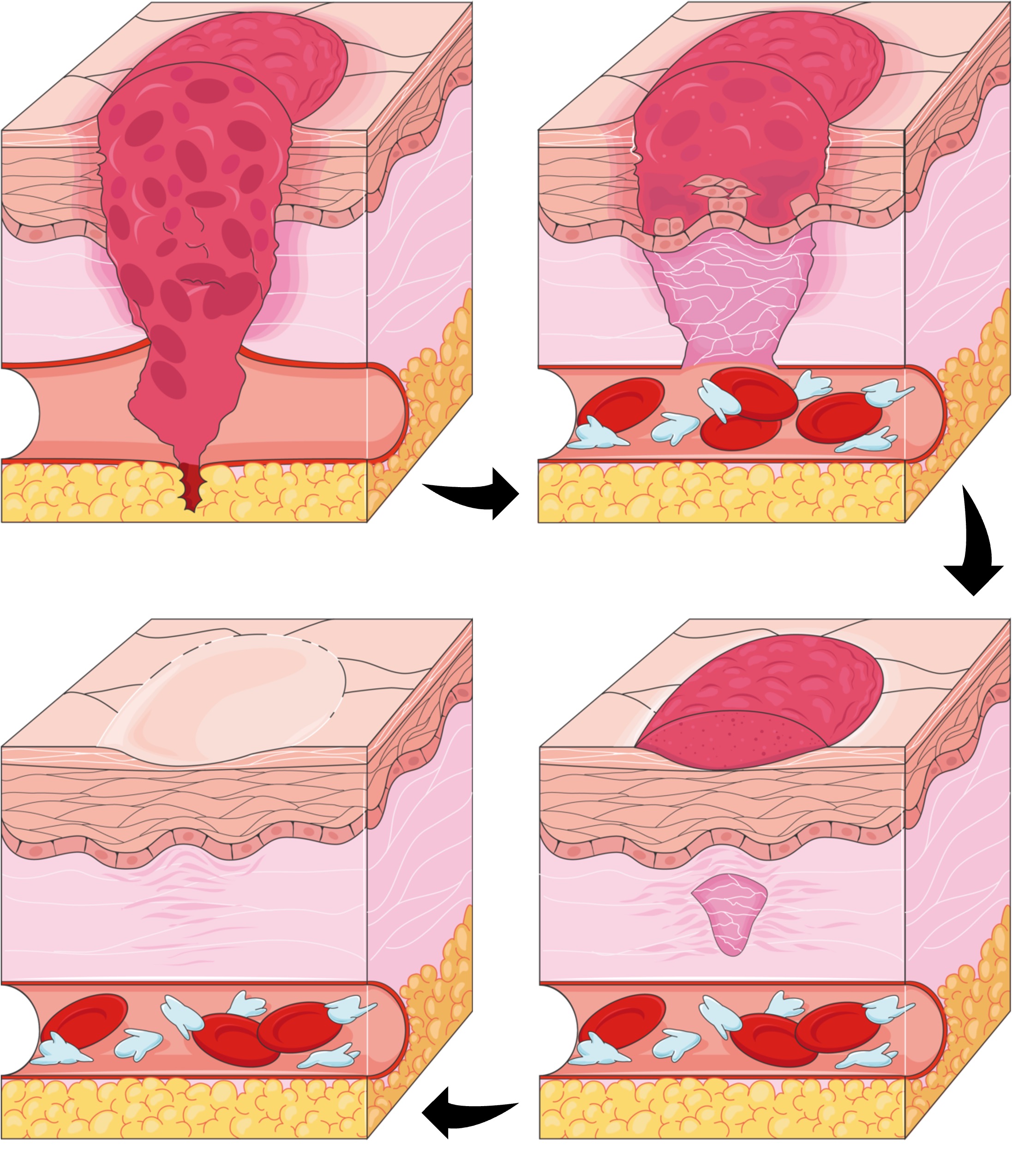 tissue%20repair%20mobile